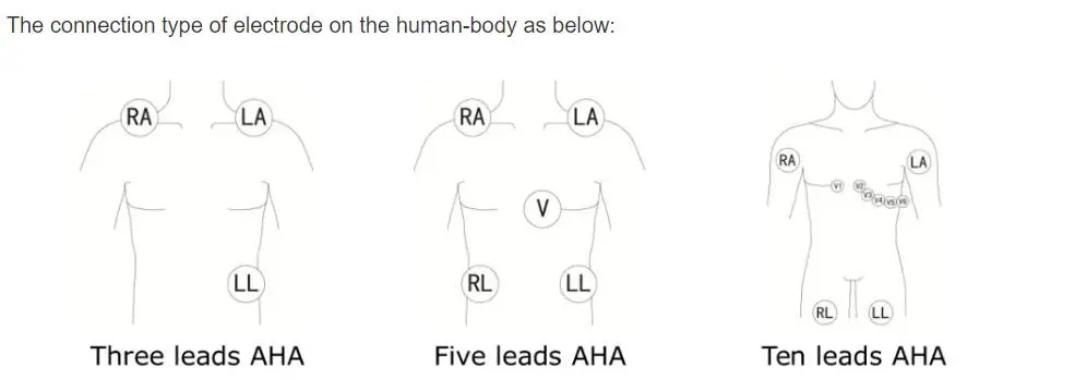 5 linii de plumb ECG pentru Philips digitrak plus 24 de ore 3100A, 5-lead, Snap